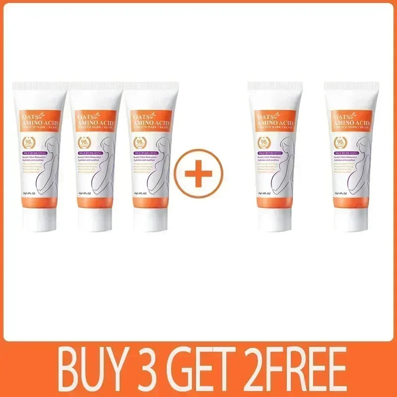 Removes Stretch Mark Cream To Remove Postpartum Obesity Pregnant Women Repair Anti-Aging Winkles Firming Body Cream Skin Care