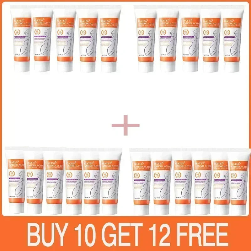 Removes Stretch Mark Cream To Remove Postpartum Obesity Pregnant Women Repair Anti-Aging Winkles Firming Body Cream Skin Care