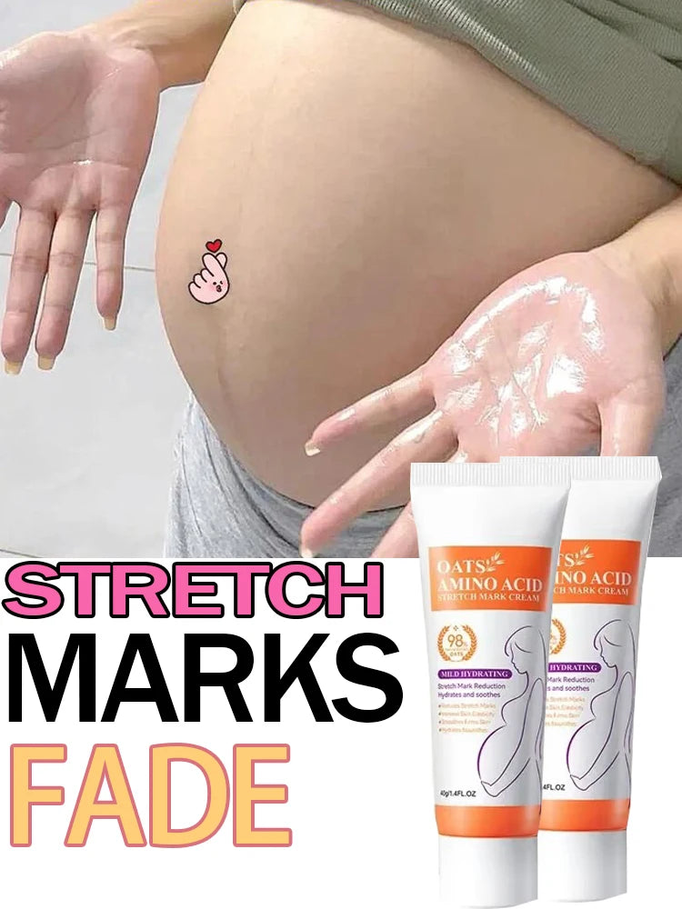 Removes Stretch Mark Cream To Remove Postpartum Obesity Pregnant Women Repair Anti-Aging Winkles Firming Body Cream Skin Care