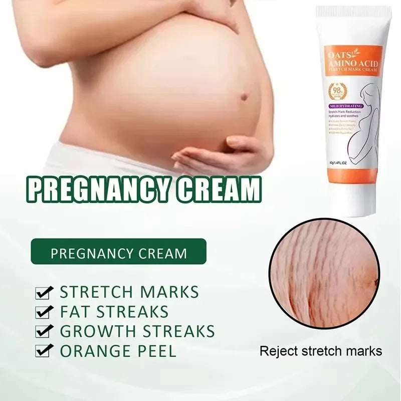Removes Stretch Mark Cream To Remove Postpartum Obesity Pregnant Women Repair Anti-Aging Winkles Firming Body Cream Skin Care