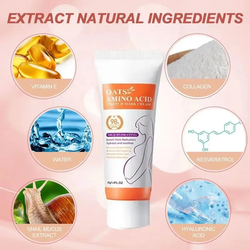 Removes Stretch Mark Cream To Remove Postpartum Obesity Pregnant Women Repair Anti-Aging Winkles Firming Body Cream Skin Care