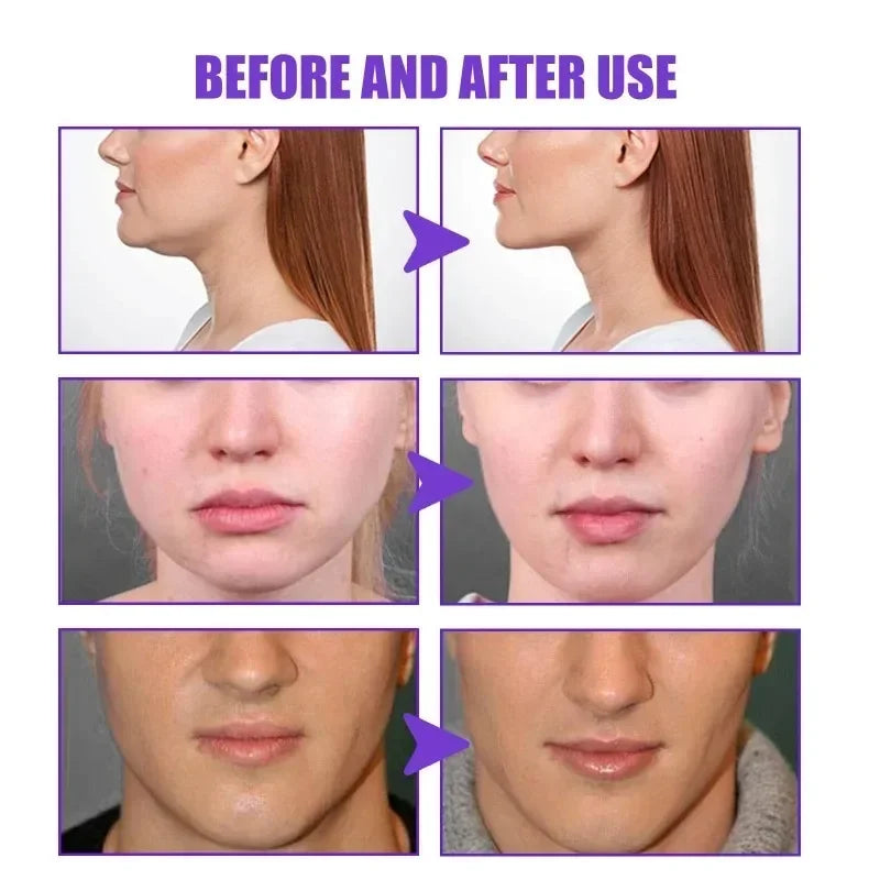Face-lift Slimming Cream Slimming Firming V-Shape Removal Masseter Muscle Double Chin Face Fat Burning Anti-aging Products 30g