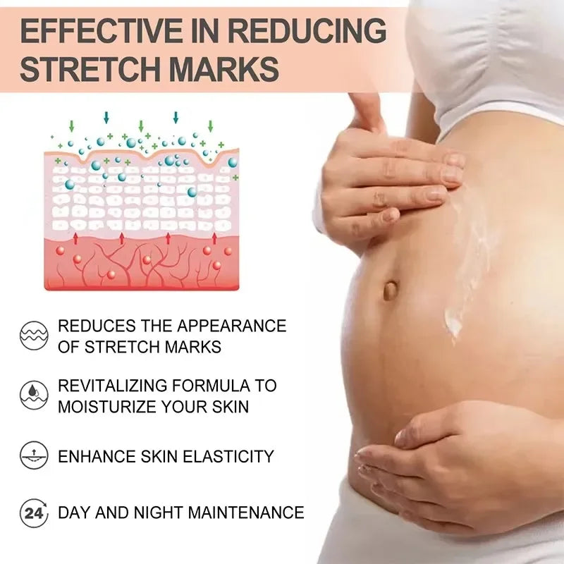 Removes Stretch Mark Cream To Remove Postpartum Obesity Pregnant Women Repair Anti-Aging Winkles Firming Body Cream Skin Care